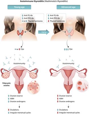 Polycystic ovary syndrome and thyroid disorder: a comprehensive narrative review of the literature